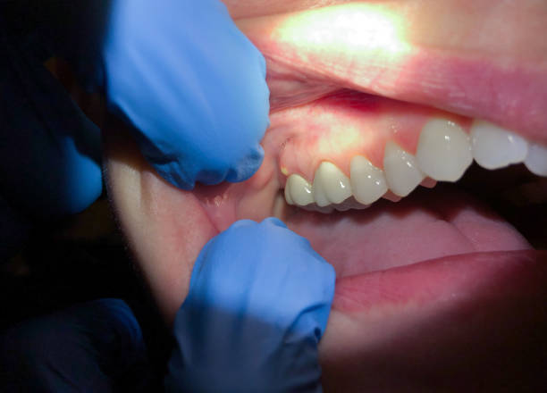 Best 24-Hour Emergency Dental Care in Mackinaw, IL