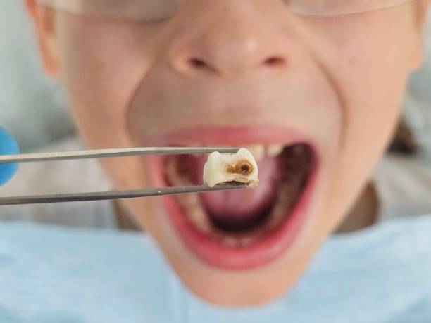 Best Emergency Root Canal Therapy in Mackinaw, IL